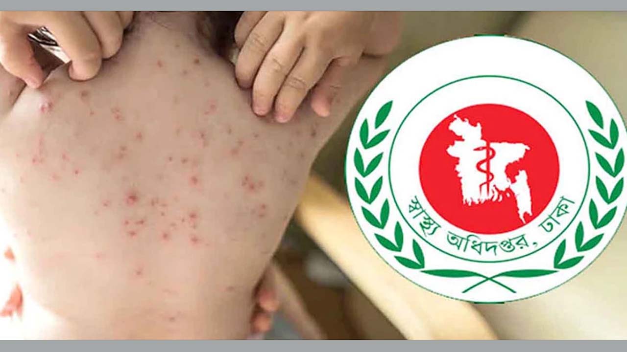 স্বাস্থ্য অধিদফতরের সার্বক্ষণিক নজরদারি