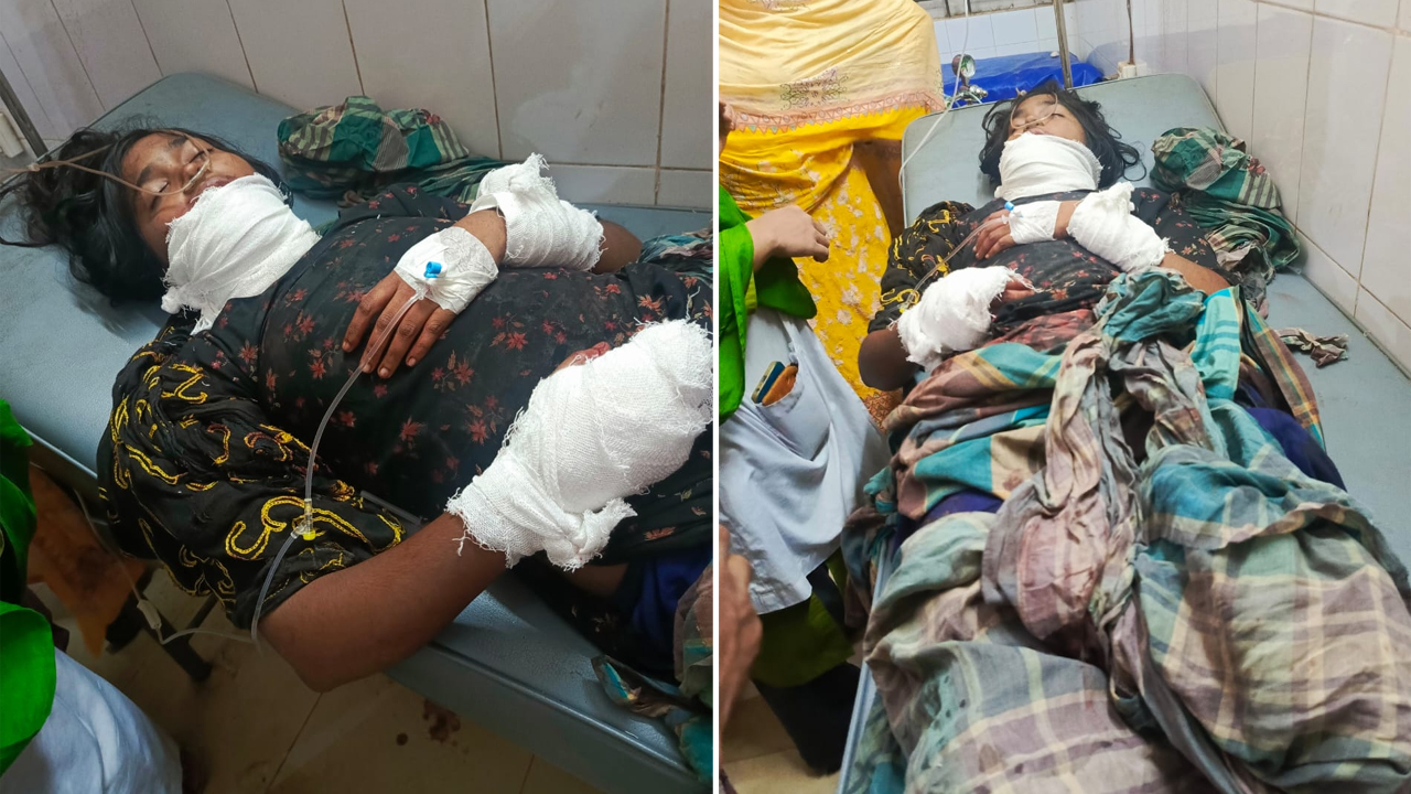 আহত কিশোরীর অবস্থা গুরুতর বলে জানা গেছে