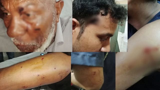 আহত পুলিশ সদস্যরা