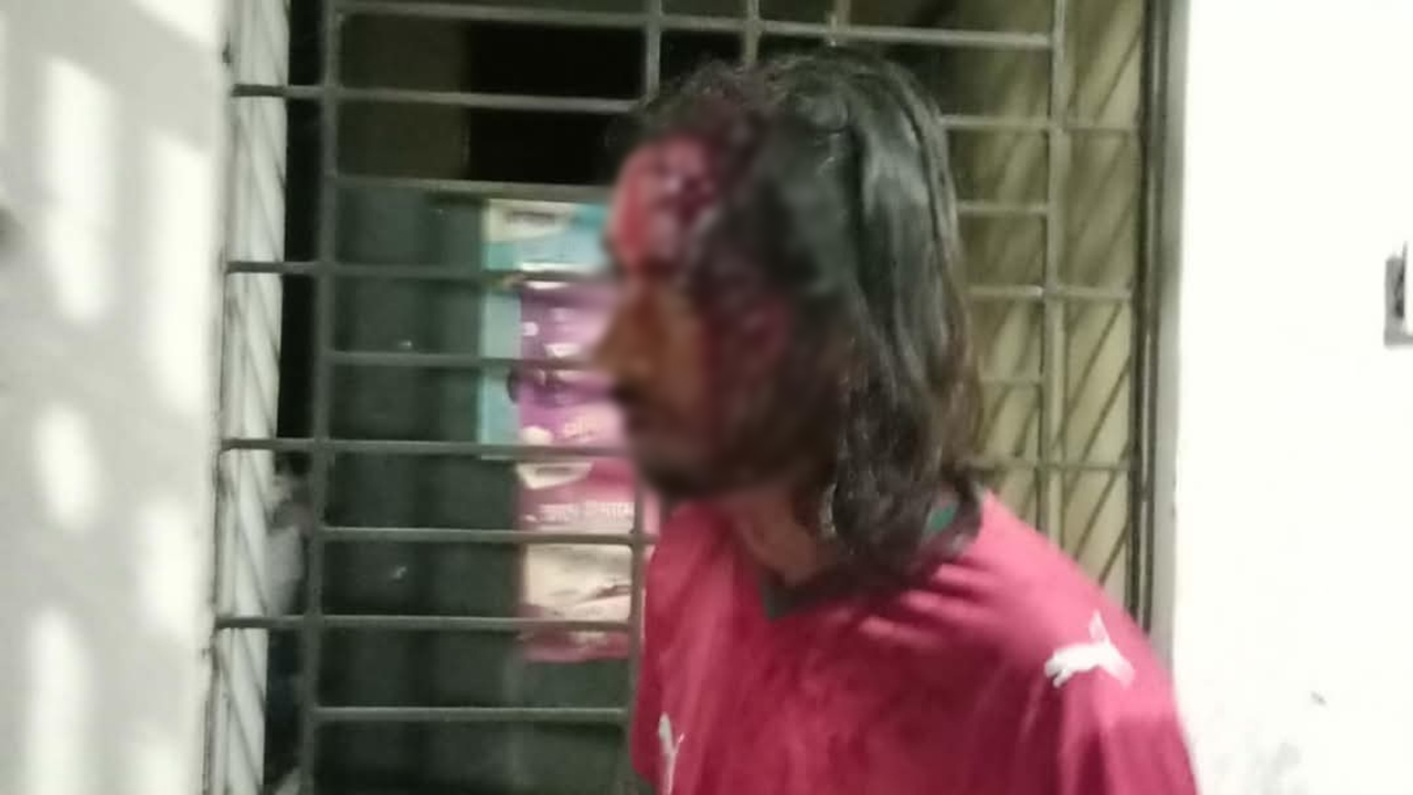 সংঘর্ষে আহত ছাত্রদল কর্মী