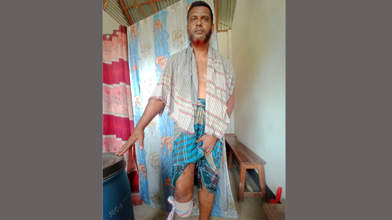 পঙ্গু রানা মিয়া