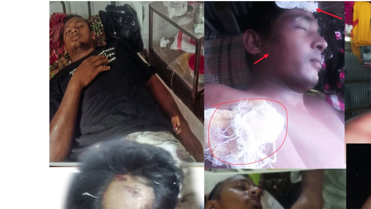 হামলায় আহতরা