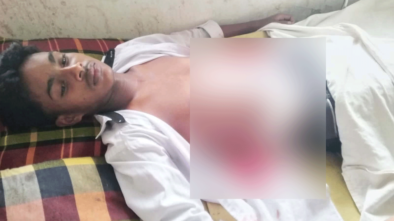 আহত স্কুলছাত্র রাফি হাসপাতালে চিকিৎসাধীন