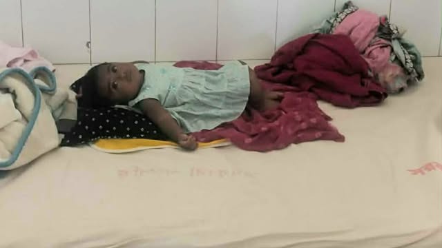 হাম আক্রান্ত শিশু