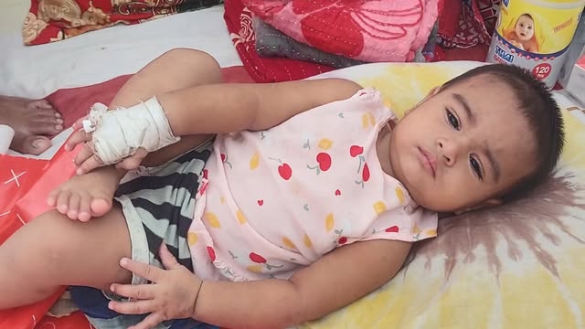 হামে আক্রান্ত শিশু