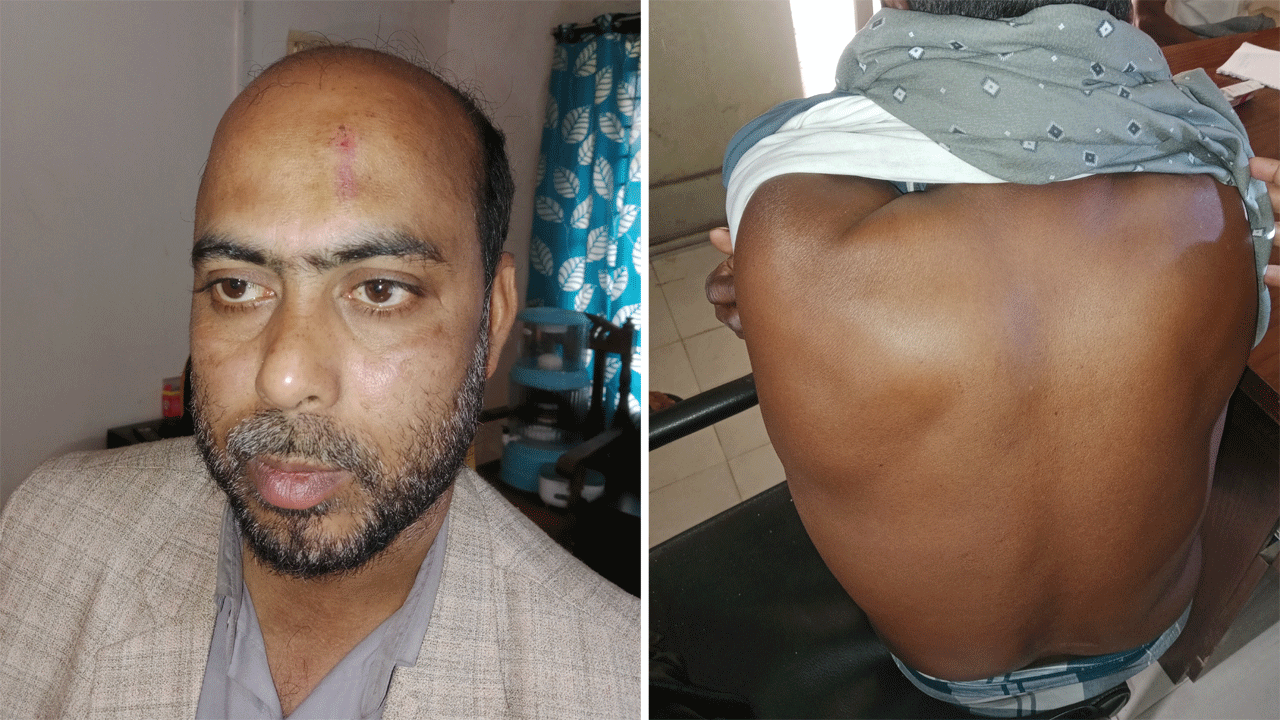 বিএনপির কর্মীদের হামলায় আহত জামায়াত কর্মী