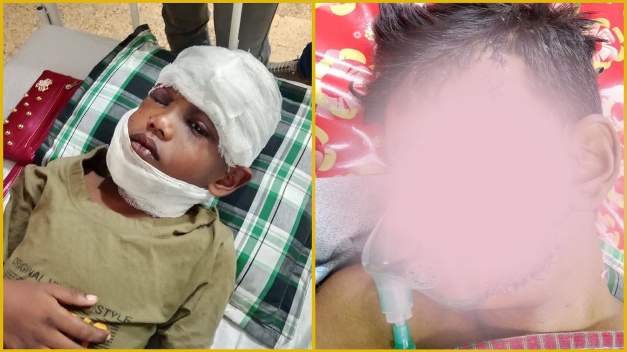 সড়ক দুর্ঘটনায় আহত হয়ে চিকিৎসাধীন এতিম ২ ভাই