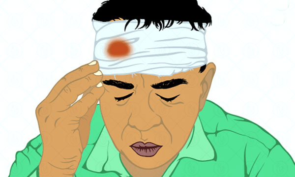 মাথায় আঘাতে নয় অবহেলা