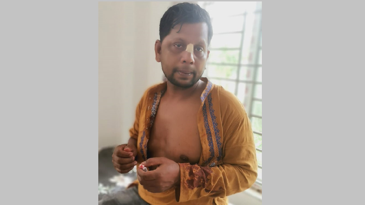 আহত জসিম উদ্দিন