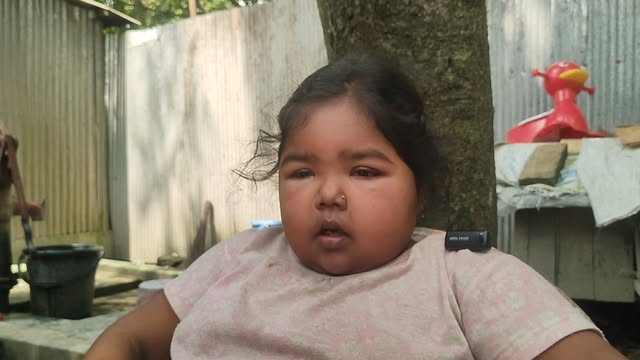 জটিল রোগে আক্রান্ত জুঁই