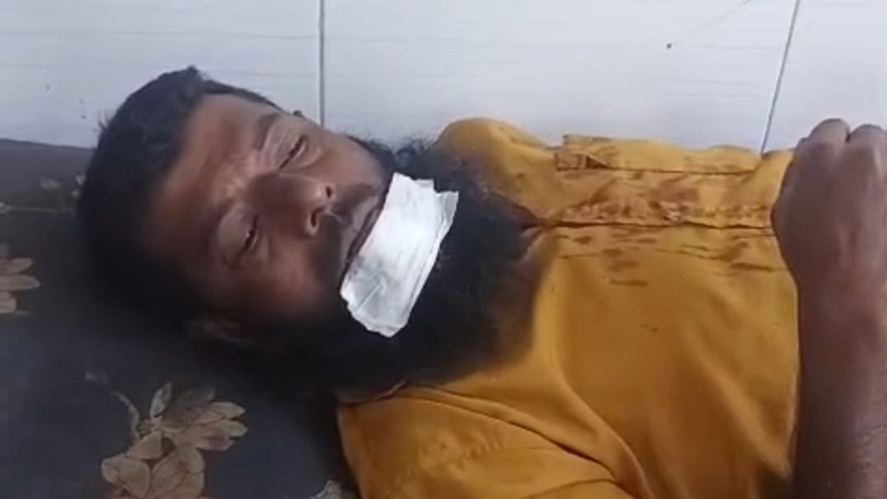 হামলায় আহত ব্যক্তি