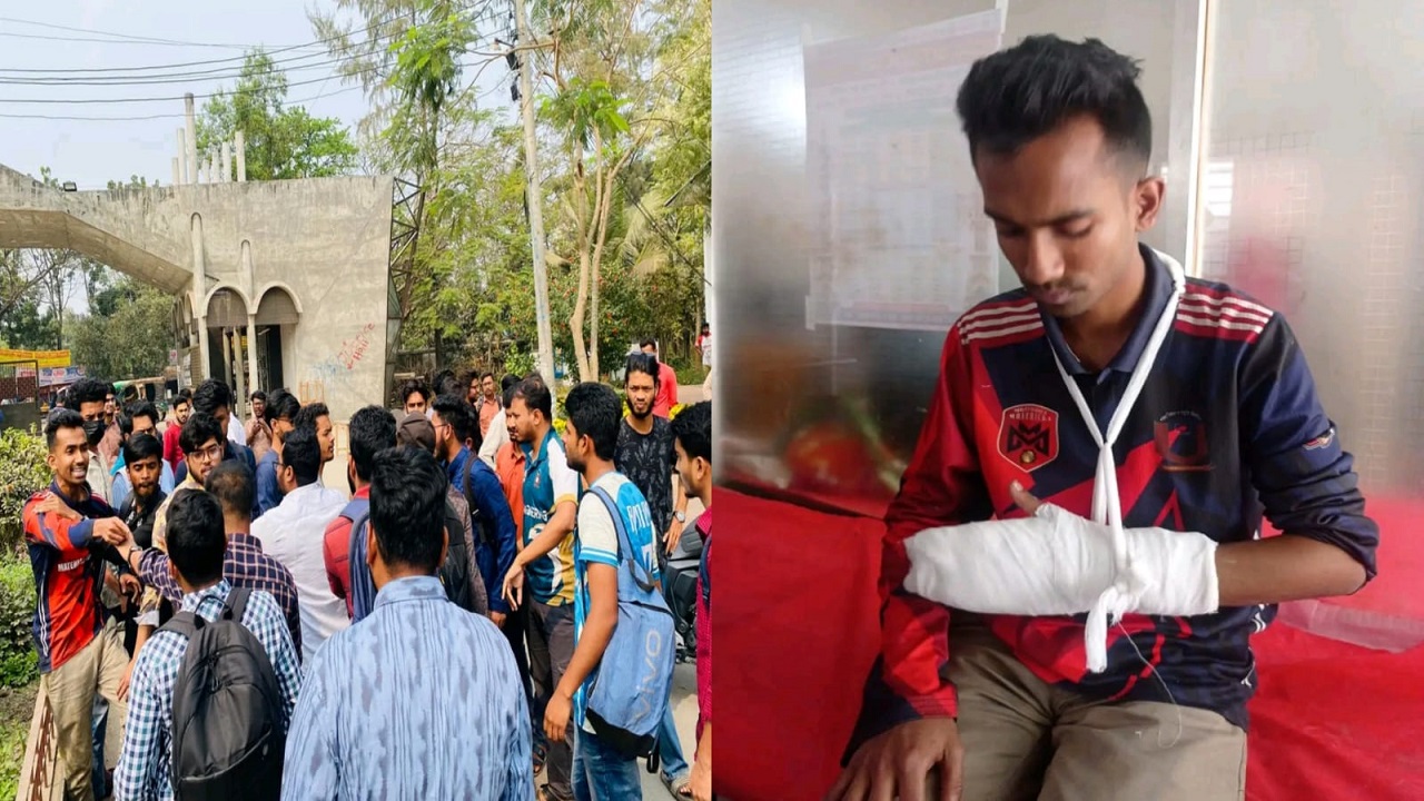 পাবিপ্রবিতে ছাত্রদল সভাপতির দুই গ্রুপের হাতাহাতি, আহত ১