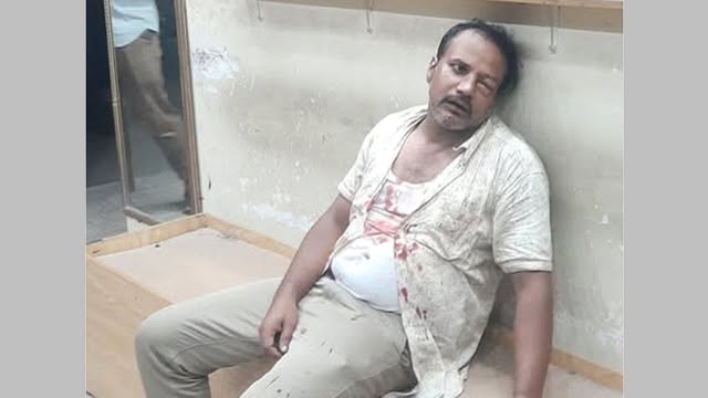 স্বেচ্ছাসেবক দল নেতাকে মারধর, ৬ কর্মকর্তাসহ ১১ পুলিশ সদস্য বরখাস্ত | দৈনিক  নয়া দিগন্ত