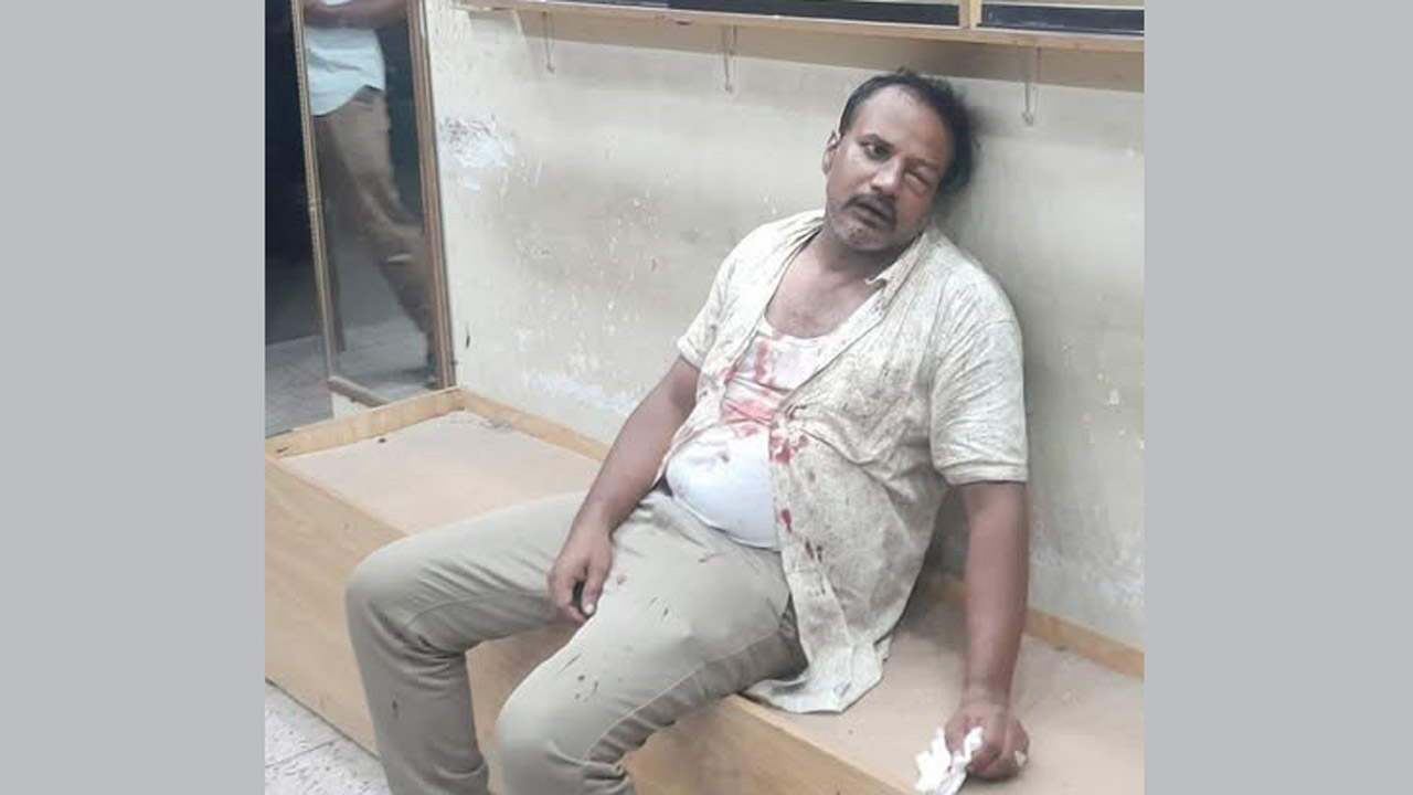 মারধরে আহত রাকিবুল ইসলাম রাকিব