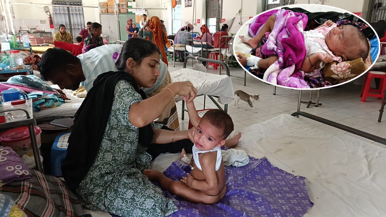 সিলেটে বাড়ছে হাম আতঙ্ক, হাসপাতালে আরো ২৬