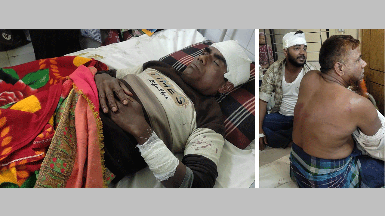 স্বতন্ত্র প্রার্থীর অনুসারিদের হামলায় আহত বিএনপির নেতাকর্মী