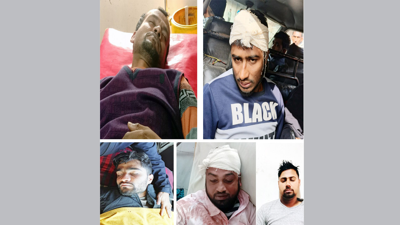 আহতদের কয়েকজন