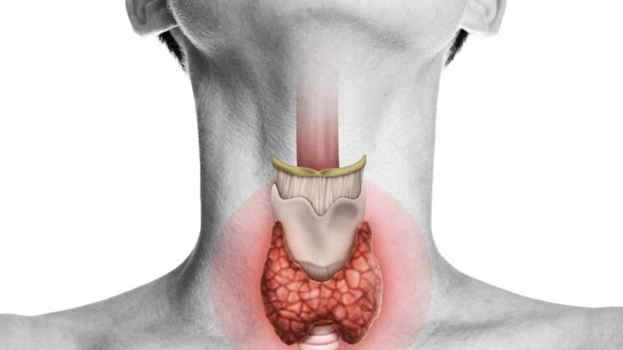 থাইরয়েড