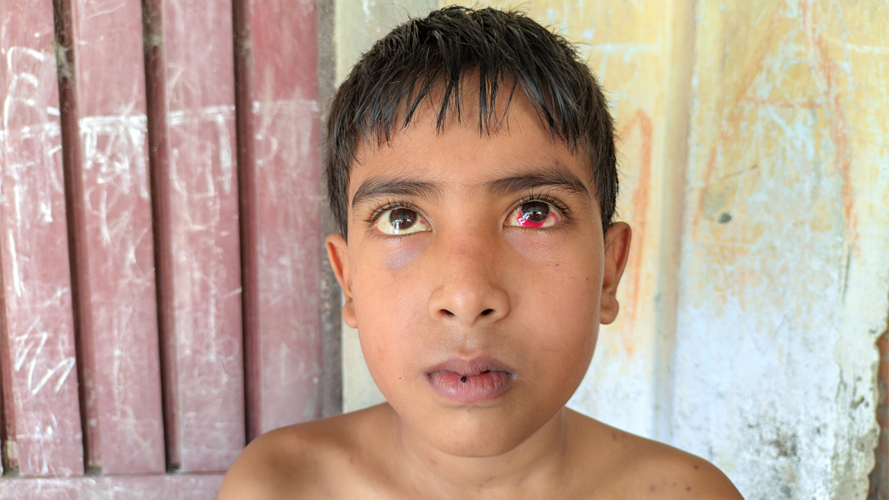 থ্যালাসেমিয়ায় ভুগা মোখলেছুর