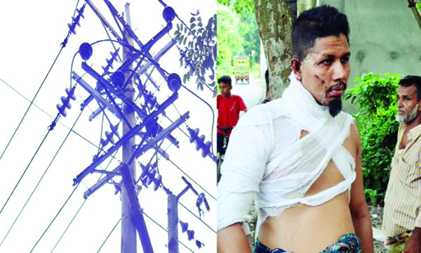 বৈদ্যুতিক খুঁটির তার থেকে আগুন ছিটকে আহত হন আরিফ : নয়া দিগন্ত