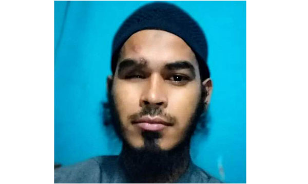 জুলাই আন্দোলনে চোখ হারিয়ে কষ্টের জীবন বাবুর