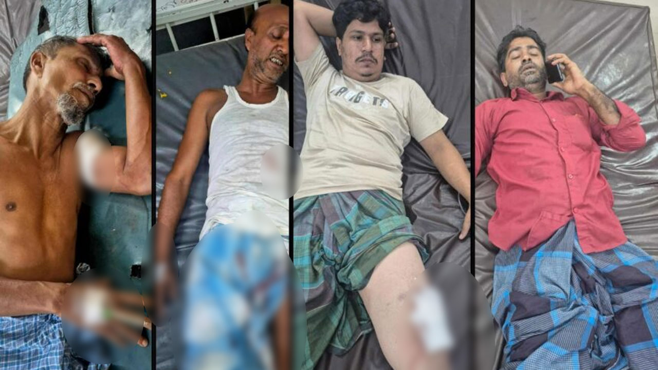 রাউজানে দুর্বৃত্তদের হামলায় গুলিবিদ্ধ ৫