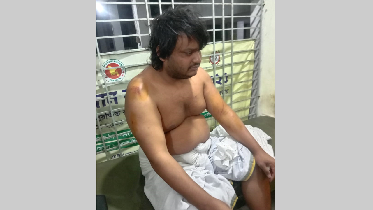 হামলায় জামায়াতের ৩ কর্মী আহত