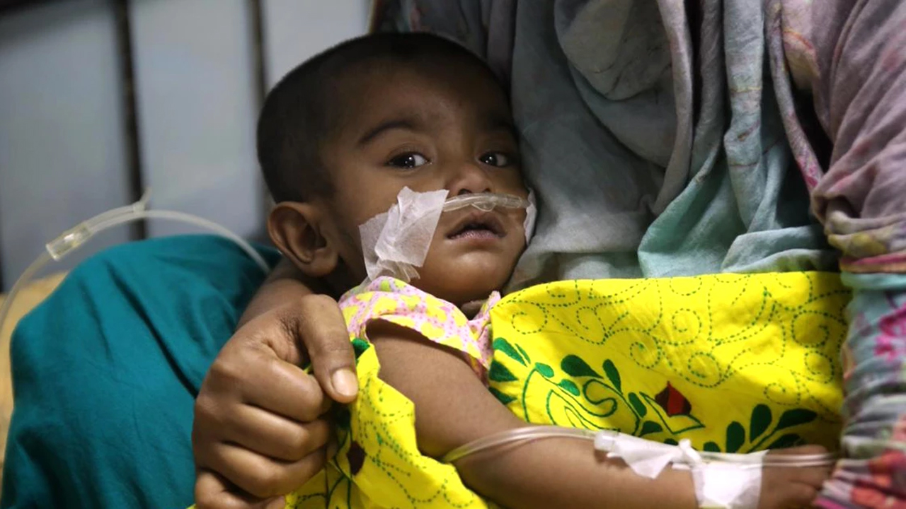 হামের উপসর্গ নিয়ে হাসপাতালে ভর্তি শিশু